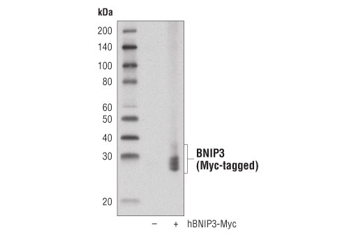 undefined Image 14: Mitophagy Antibody Sampler Kit