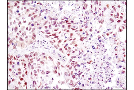 Immunohistochemistry Image 3: HMGB1 (D3E5) Rabbit Monoclonal Antibody (BSA and Azide Free)