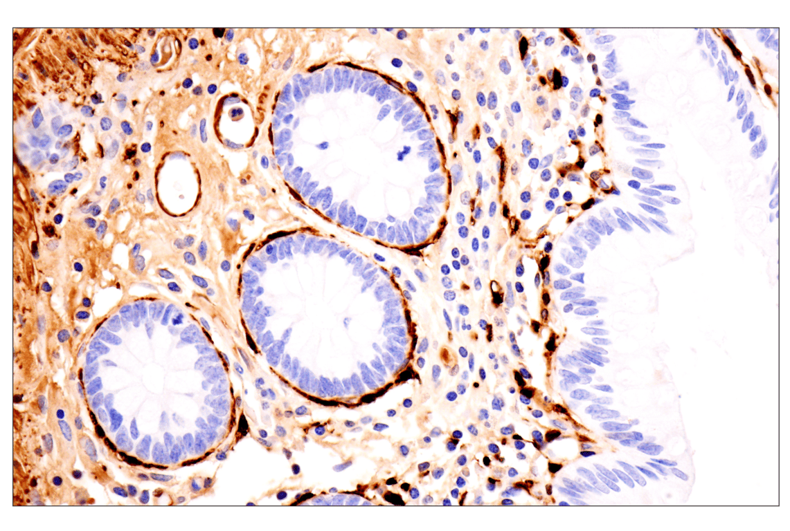 Immunohistochemistry Image 10: Transgelin/TAGLN (F3B7H) Rabbit Monoclonal Antibody