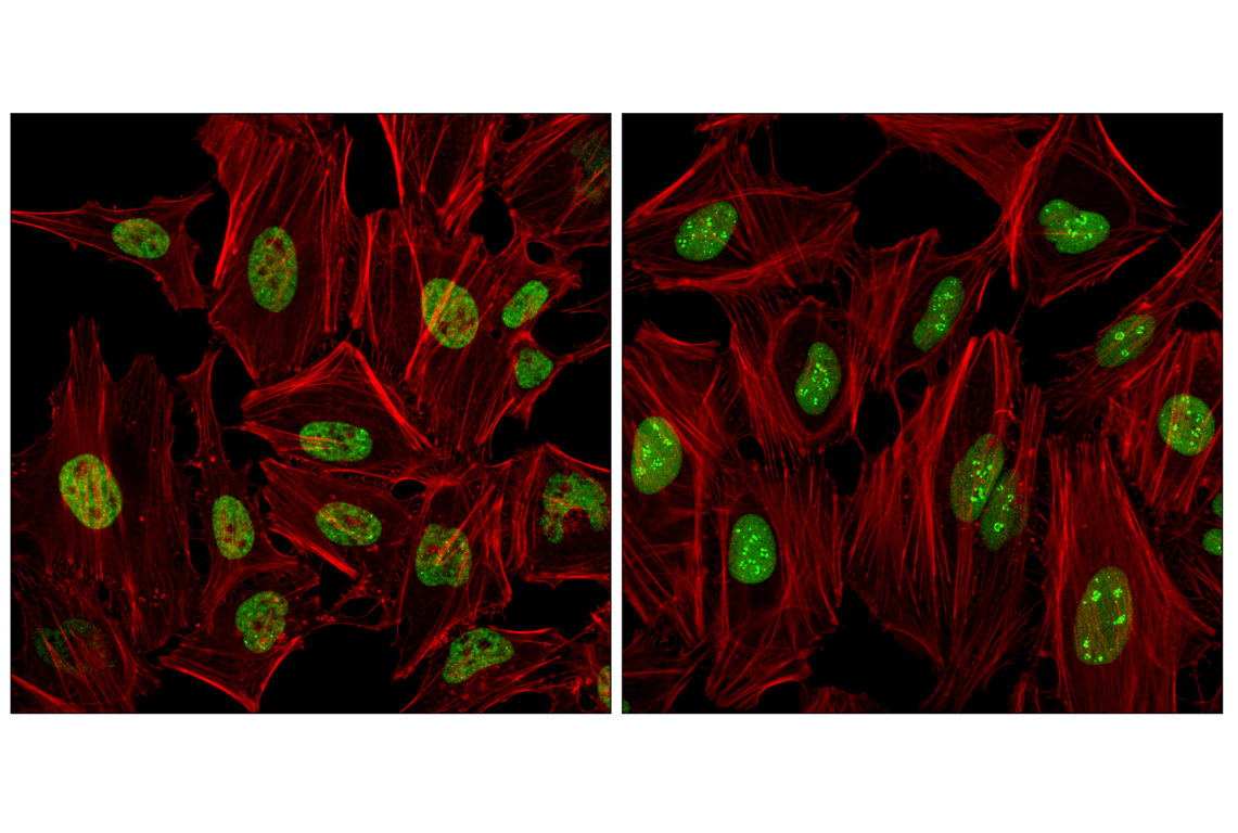 Immunofluorescence Image 2: SFPQ (F7S2Q) Rabbit Monoclonal Antibody