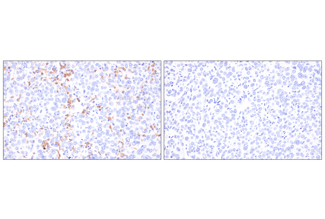 Immunohistochemistry Image 5: MHC Class II (I-E alpha) (F8N7J) Rabbit Monoclonal Antibody