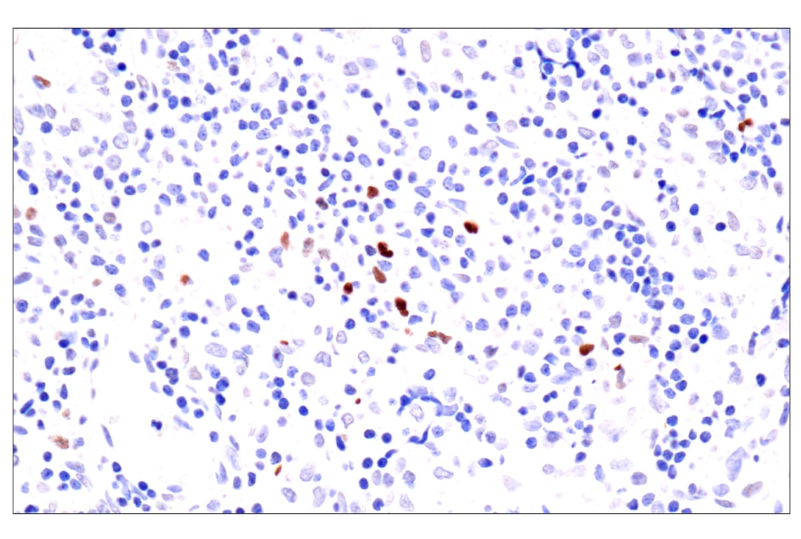 Immunohistochemistry Image 8: BATF3 (E3F3L) Rabbit Monoclonal Antibody
