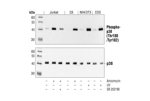 Western Blotting Image 2: Phospho-p38 MAPK (Thr180/Tyr182) (3D7) Rabbit Monoclonal Antibody