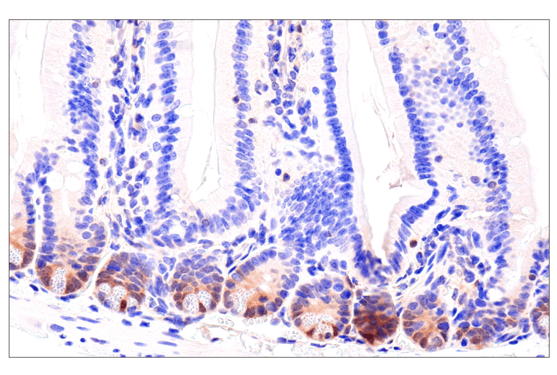 Immunohistochemistry Image 12: CDK6 (E3E3Q) Rabbit Monoclonal Antibody