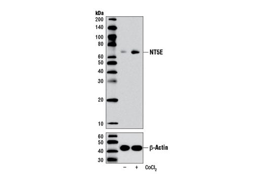 Western Blotting Image 2: NT5E/CD73 (D7F9A) Rabbit Monoclonal Antibody