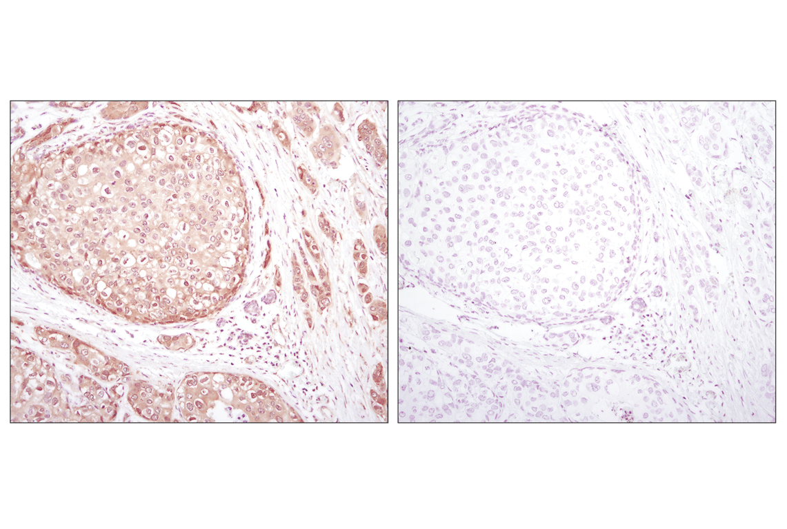 Immunohistochemistry Image 2: Akt (pan) (C67E7) Rabbit Monoclonal Antibody