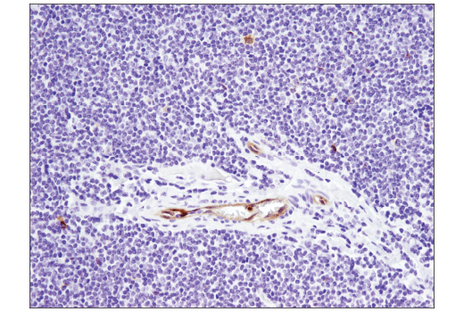 Immunohistochemistry Image 3: TNFRSF8/CD30 (E4L4I) Rabbit Monoclonal Antibody