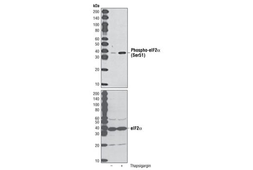 Western Blotting Image 1: Phospho-eIF2α (Ser51) (D9G8) XP<sup>®</sup> Rabbit mAb (BSA and Azide Free)