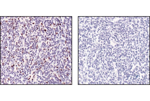 Immunohistochemistry Image 1: PU.1 (9G7) Rabbit Monoclonal Antibody (BSA and Azide Free)