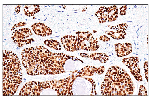 Immunohistochemistry Image 2: Sox10 (E6B6I) Rabbit Monoclonal Antibody (BSA and Azide Free)