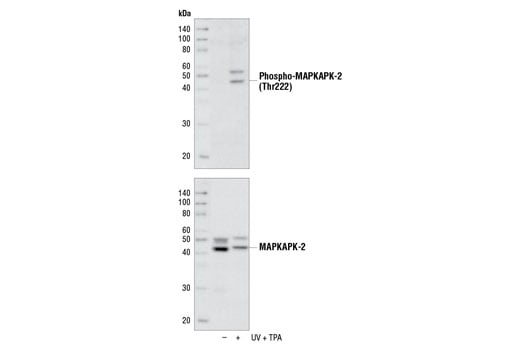 undefined Image 6: MAPKAPK-2 Antibody Sampler Kit
