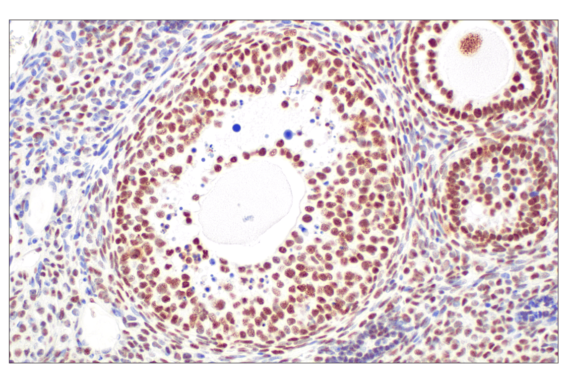 Immunohistochemistry Image 10: CBX7 (E7N1W) Rabbit Monoclonal Antibody