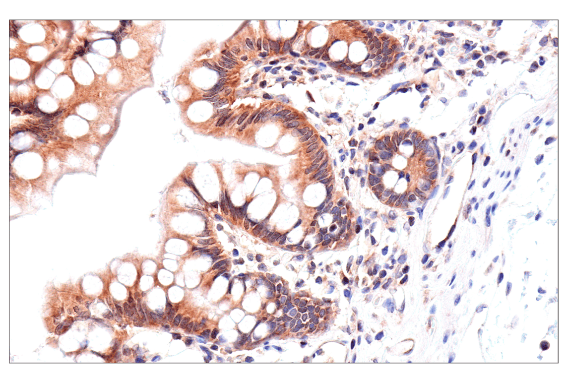 Immunohistochemistry Image 9: ADAR1 p150 Isoform (E6U1U) Rabbit Monoclonal Antibody