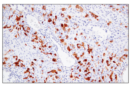 Immunohistochemistry Image 4: RRM2 (E7Y9J) Rabbit Monoclonal Antibody