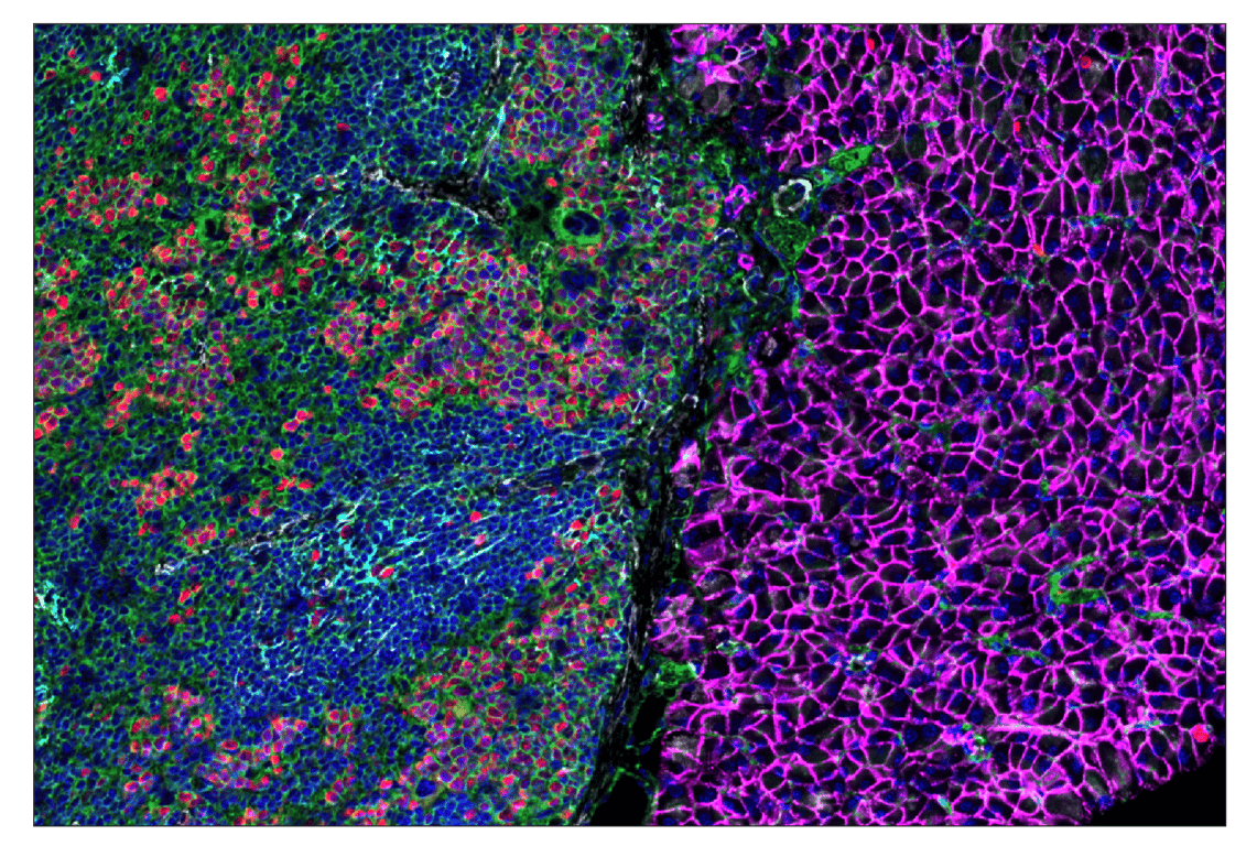 Immunohistochemistry Image 5: CD47 (E2V9V) & CO-0141-647 SignalStar<sup>™</sup> Oligo-Antibody Pair