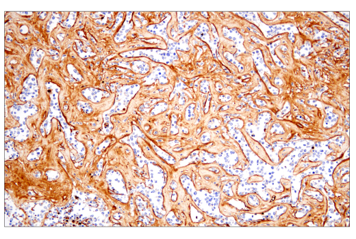 Immunohistochemistry Image 4: Fibronectin/FN1 (E5H6X) Rabbit Monoclonal Antibody (BSA and Azide Free)