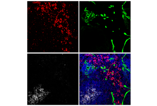 Immunofluorescence Image 2: Ki-67 (D3B5) Rabbit Monoclonal Antibody (Alexa Fluor<sup>®</sup> 594 Conjugate)