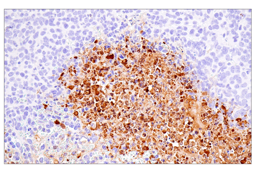 undefined Image 32: NETosis Antibody Sampler Kit