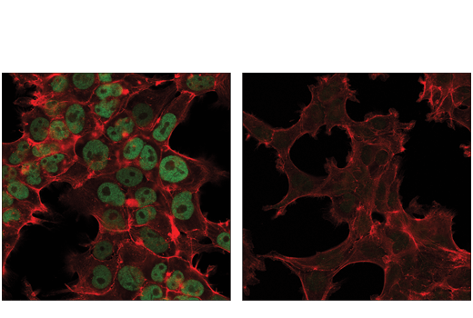 Immunofluorescence Image 1: DNMT3A (D2H4B) Rabbit Monoclonal Antibody