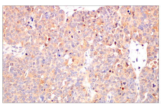 Immunohistochemistry Image 4: c-Rel (E8Z5Y) Rabbit Monoclonal Antibody (BSA and Azide Free)