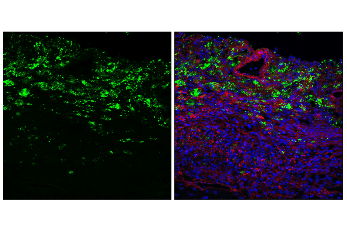 Immunofluorescence Image 1: Granzyme C (E5M3N) Rabbit Monoclonal Antibody (BSA and Azide Free)