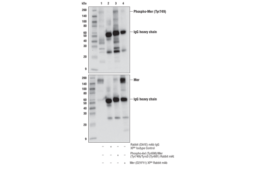 Immunoprecipitation Image 2: Phospho-Axl (Tyr698)/Mer (Tyr749)/Tyro3 (Tyr681) (D6M4W) Rabbit Monoclonal Antibody