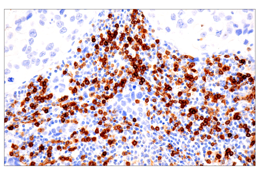 Immunohistochemistry Image 2: TRBC1/TCR beta constant region 1 (E6Z3S) Rabbit Monoclonal Antibody (BSA and Azide Free)