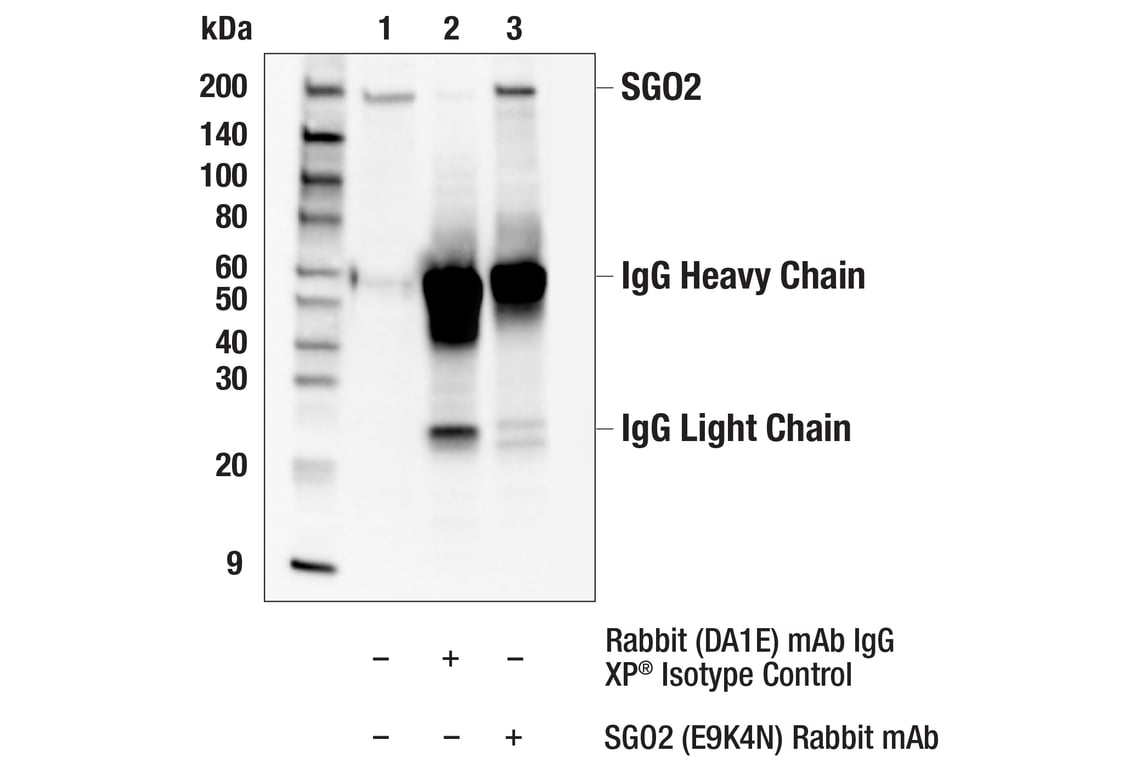 Immunoprecipitation Image 1: SGO2 (E9K4N) Rabbit Monoclonal Antibody