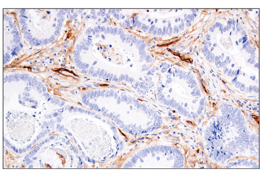 Immunohistochemistry Image 1: CD141/Thrombomodulin (E7Y9P) Rabbit Monoclonal Antibody