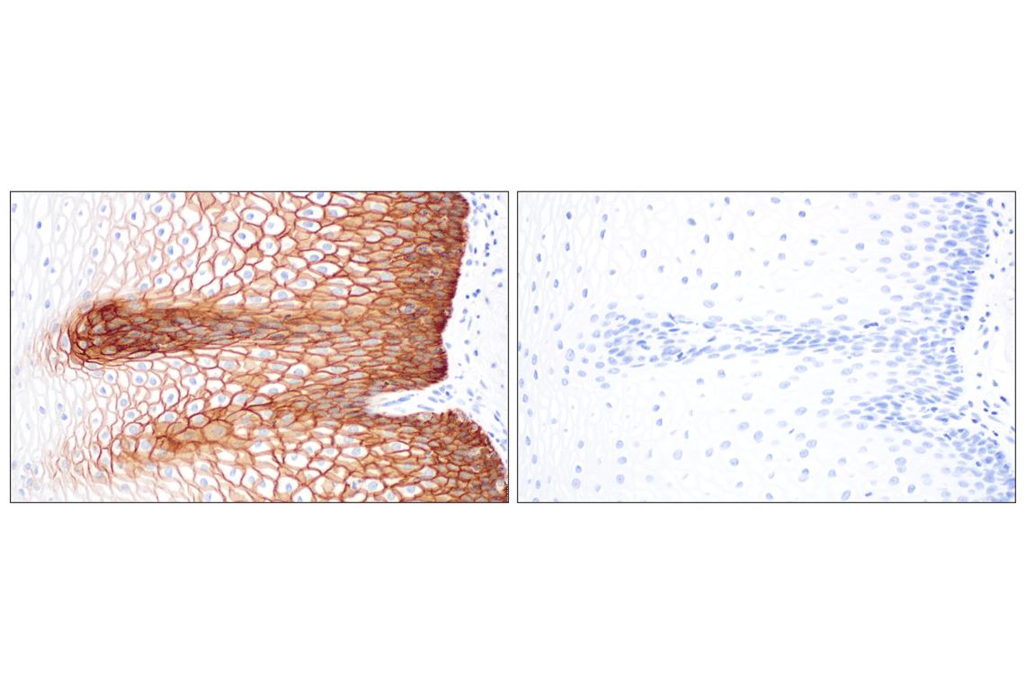 Immunohistochemistry Image 10: CD44 v5 (C44Mab-3) Mouse Monoclonal Antibody