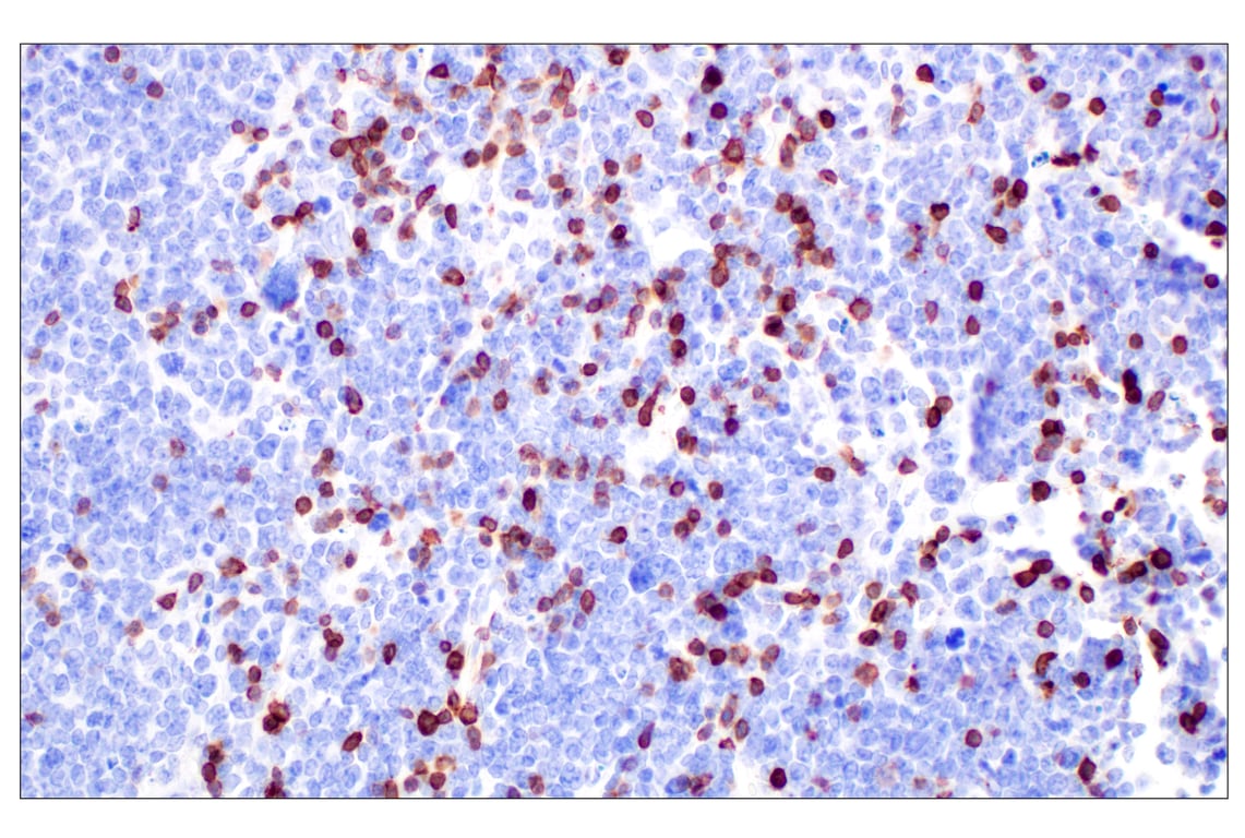 Immunohistochemistry Image 2: CD5 (E6N9S) Rabbit Monoclonal Antibody (BSA and Azide Free)