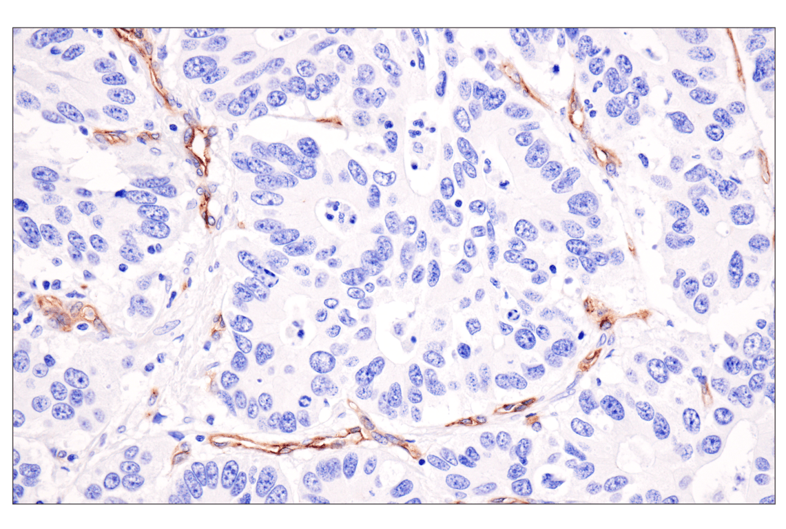 Immunohistochemistry Image 5: ESAM (F2Y5Q) Rabbit Monoclonal Antibody