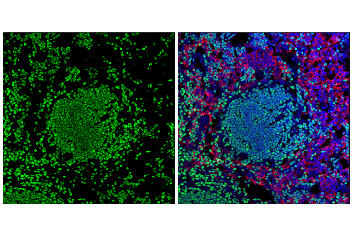 Immunofluorescence Image 1: Aiolos (D1C1E) Rabbit Monoclonal Antibody