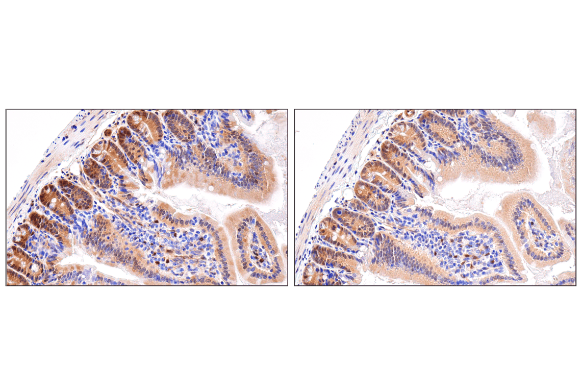 Immunohistochemistry Image 6: YAP (D8H1X) XP<sup>®</sup> Rabbit mAb