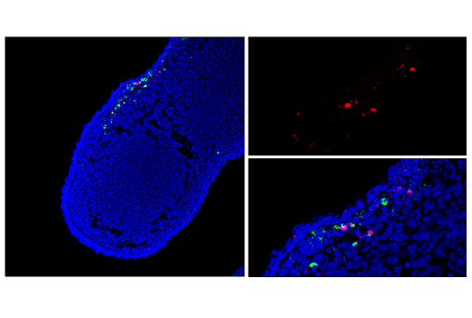 Immunofluorescence Image 1: TUNEL Assay Kit (Fluorescence, 594 nm)