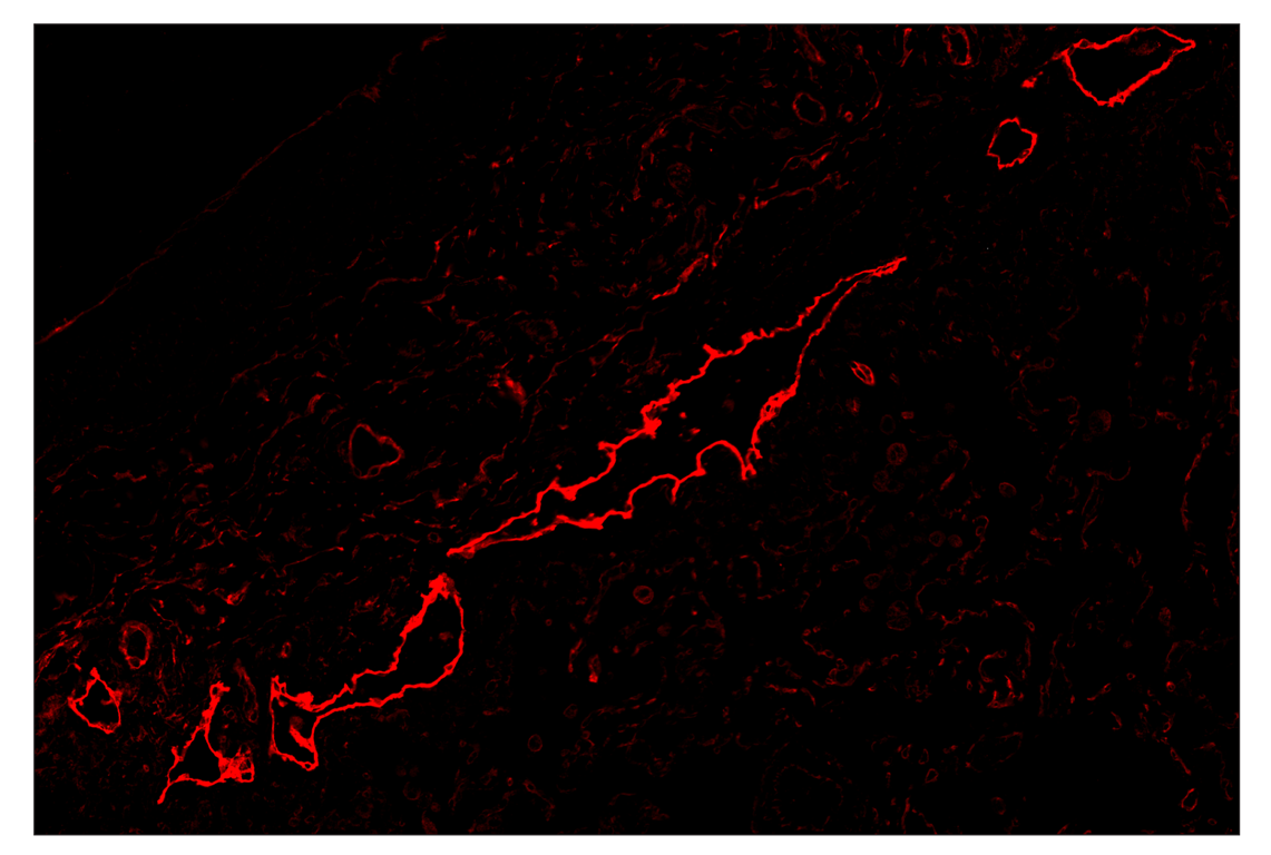 Immunohistochemistry Image 4: NT5E/CD73 (D7F9A) & CO-0039-594 SignalStar<sup>™</sup> Oligo-Antibody Pair
