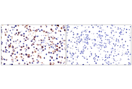 Immunohistochemistry Image 6: CD7 (LP15) Mouse Monoclonal Antibody