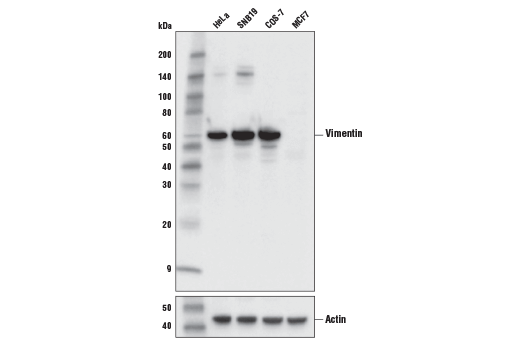 Western Blotting Image 2: Vimentin (V9) Mouse Monoclonal Antibody