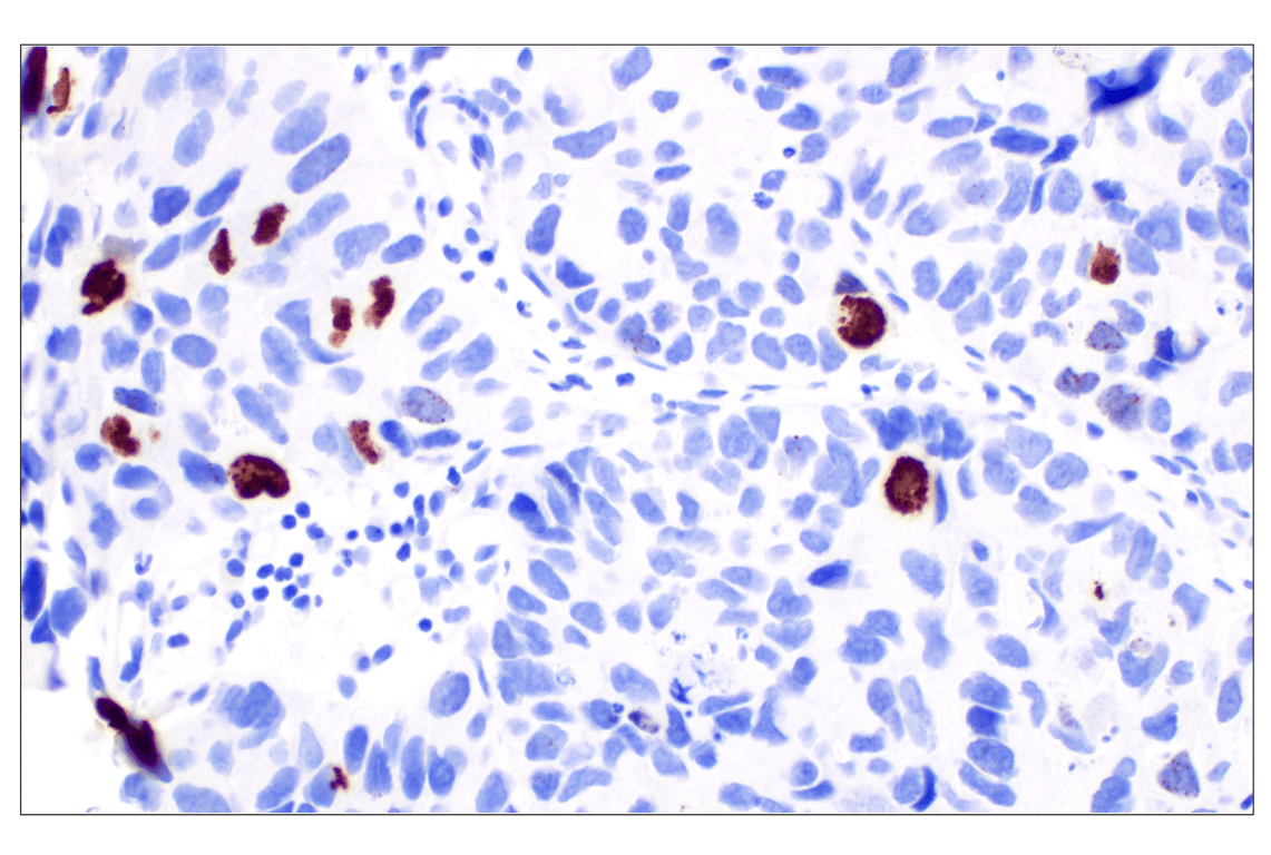Immunohistochemistry Image 2: Phospho-Histone H3 (Ser10) (D7N8E) Rabbit Monoclonal Antibody