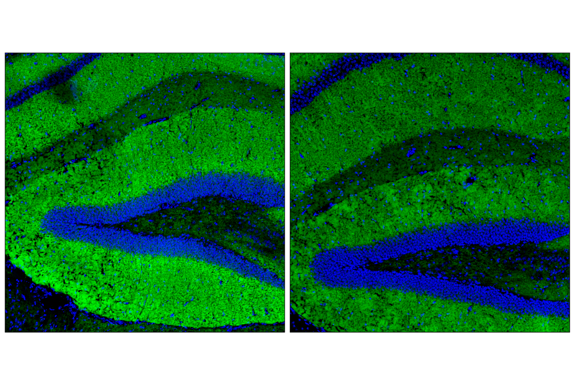 Immunofluorescence Image 1: SynGAP-alpha2 (E4Y6I) Rabbit Monoclonal Antibody