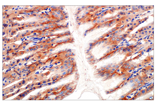 Immunohistochemistry Image 6: Ras (E8N8L) Rabbit Monoclonal Antibody (BSA and Azide Free)