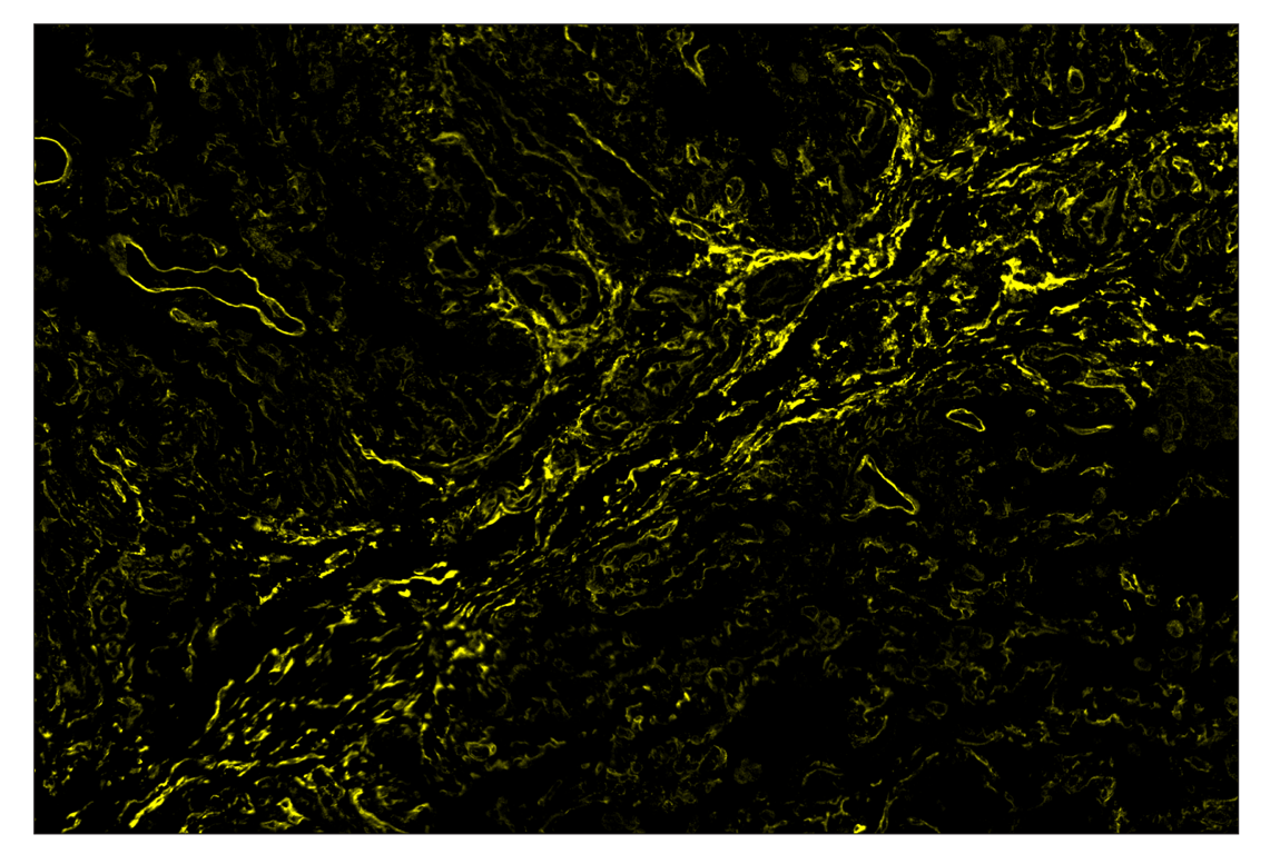 Immunohistochemistry Image 3: NT5E/CD73 (D7F9A) & CO-0039-594 SignalStar<sup>™</sup> Oligo-Antibody Pair