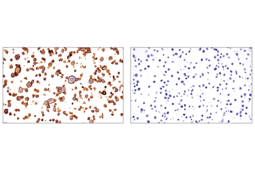 Immunohistochemistry Image 4: CD86 (E2G8P) Rabbit Monoclonal Antibody