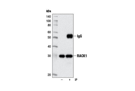 Immunoprecipitation Image 1: RACK1 (D59D5) Rabbit Monoclonal Antibody