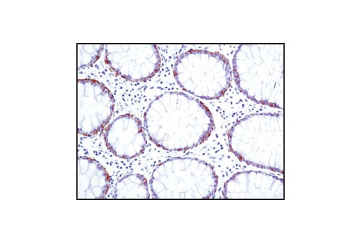 Immunohistochemistry Image 2: EpCAM (VU1D9) Mouse Monoclonal Antibody