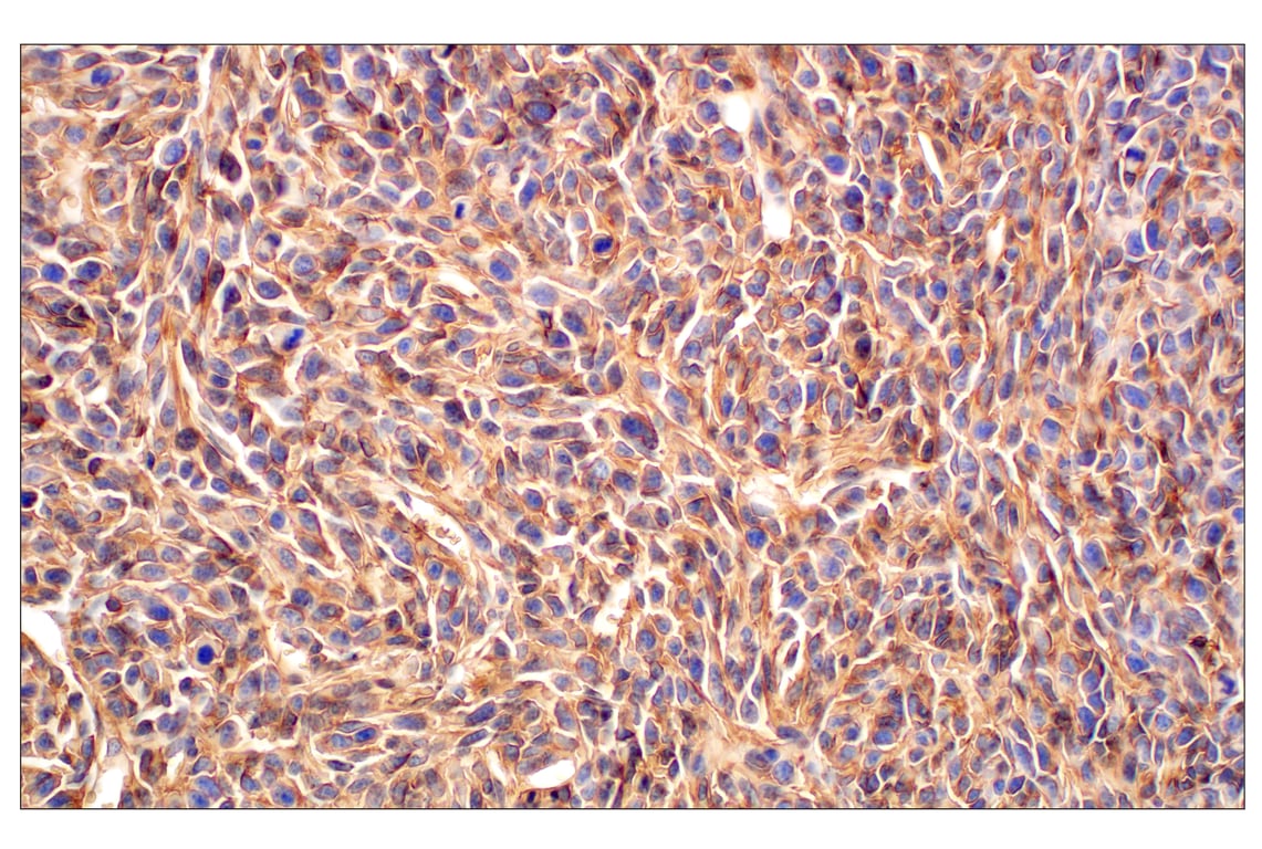 Immunohistochemistry Image 7: CD47 (E2V9V) Rabbit Monoclonal Antibody (BSA and Azide Free)