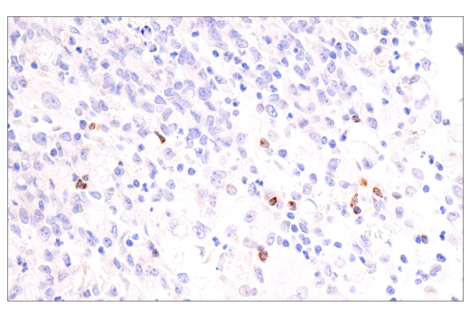 Immunohistochemistry Image 4: CTLA-4 (E2V1Z) Rabbit Monoclonal Antibody
