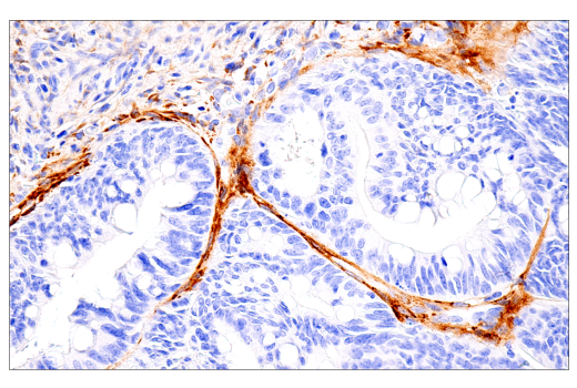 Immunohistochemistry Image 3: COL5A1 (E6U9W) Rabbit Monoclonal Antibody