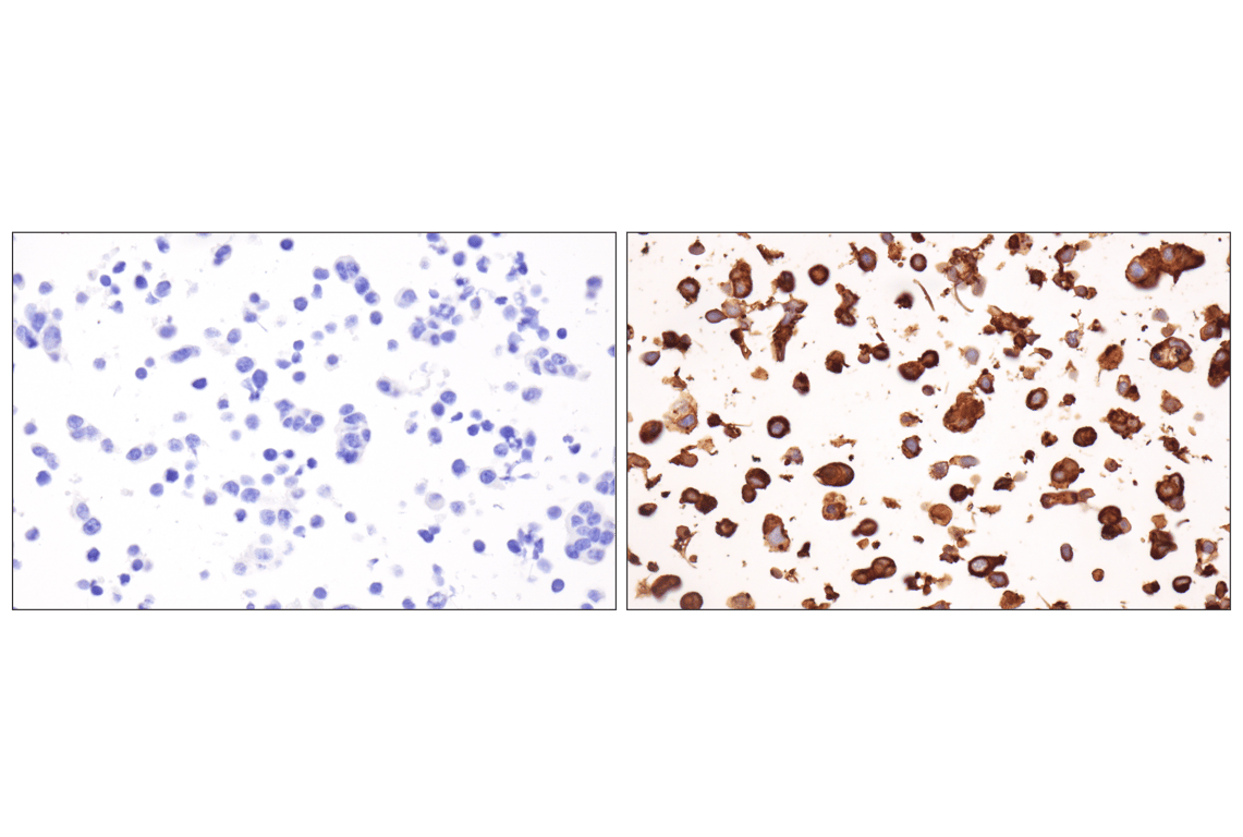 Immunohistochemistry Image 8: PD-L1 (F3Z1T) Rabbit Monoclonal Antibody (IHC Formulated)