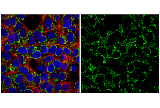 undefined Image 23: Electron Transport Chain (Complex I, III, IV) Antibody Sampler Kit